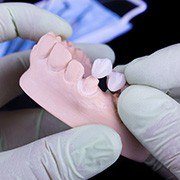 Model smile being fitted with fixed bridge