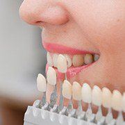 Woman's smile compared with tooth color chart