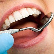 Closeup of smile during dental exam