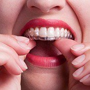 Patient placing Invisalign tray