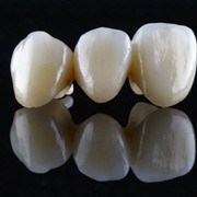 dental bridge on black background 