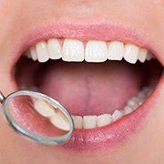 Closeup of healthy smile