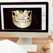 Computer screen showing computer guided dental implant surgery in Oklahoma City