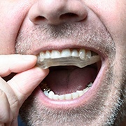 Closeup of man with dental implants in Oklahoma City wearing mouthguard