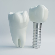 dental implant with crown next to natural tooth