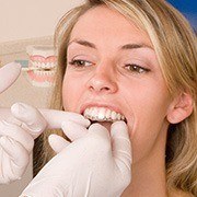 Dentist placing Invisalign tray