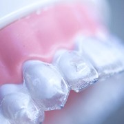 Model of Invisalign clear aligner on dental mold.