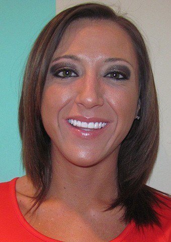 Jessica's smile after treatment