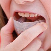A person placing a nightguard in their mouth.