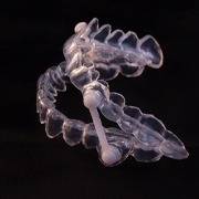 custom-fit occlusal splint for TMJ disorders