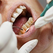 dentist treating a patient with a soft tissue laser