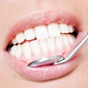 Closeup of healthy teeth and gums