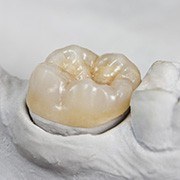 Model smile with dental crown restoration