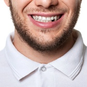 Man in a white shirt missing a single tooth