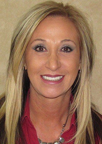 Teresa's smile after treatment