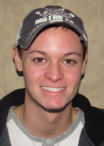 Zach's smile after treatment