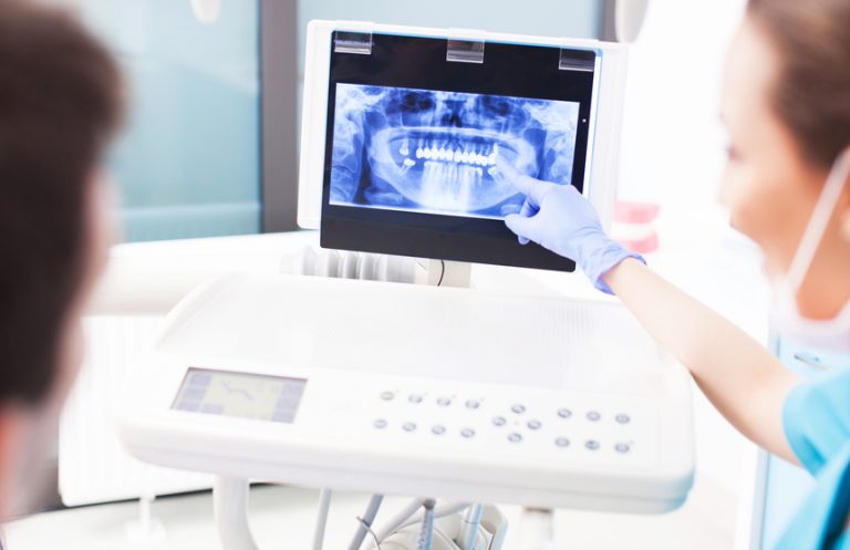 xray price for serenity dental
