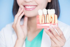 Smiling woman holding model of successful implant
